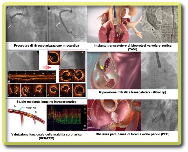 Haemodynamics and structural interventional cardiology - IMMG1